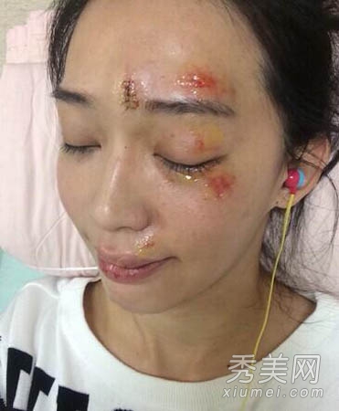 首页 头奖o2o彩票网app手机版 敏感性皮肤:最好选择物理性防晒产品